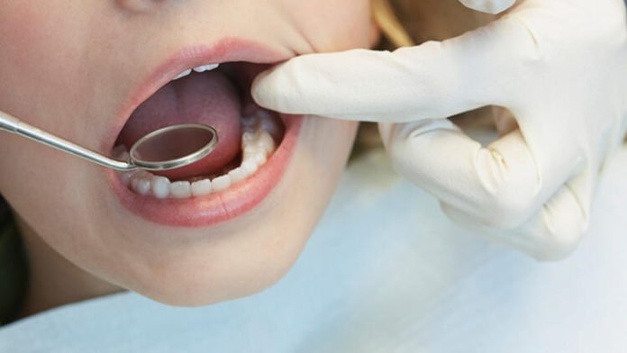 DİŞLERİNİZE İMPLANT YAPTIRMAK İSTİYORSANIZ BUNLARA DİKKAT DİŞLERİNİZE İMPLANT YAPTIRMAK İSTİYORSANIZ BUNLARA DİKKAT