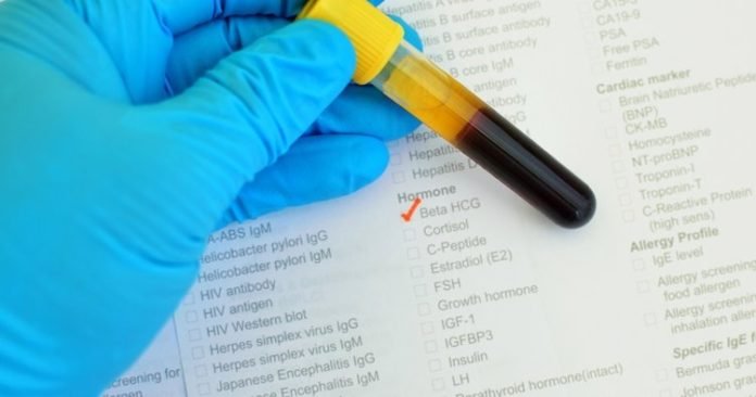 Dış Gebelikte Beta HCG Değerleri En Fazla Kaç Olur? Beta HCG Değerleri İle Dış Gebelik Nasıl Anlaşılır?