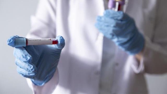 Türk Bilim İnsanlarından Müthiş İcat! Evde İdrarla Yapılan Koronavirüs Testi 15 Saniyede Sonuç Veriyor