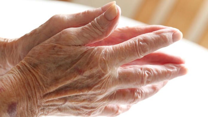 Parkinson Hastalığı Nedir ve Neden Olur?
