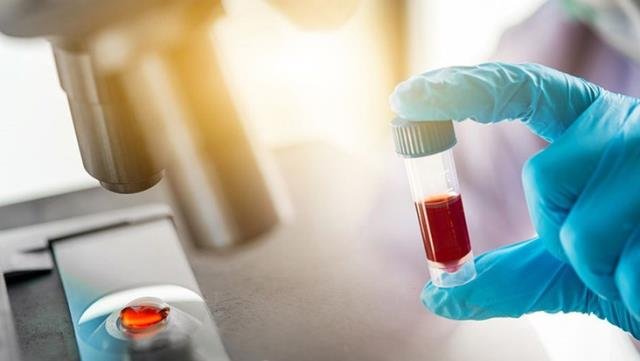 Trump'ın Tedavisinde de Kullanılan "antikor kokteyli" Koronaya Yakalanma Oranını Yüzde 81 Azaltıyor