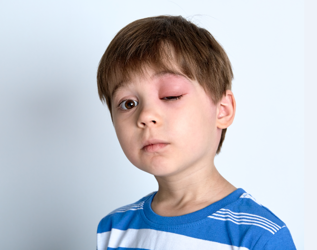 her sislik alerji olmayabilir