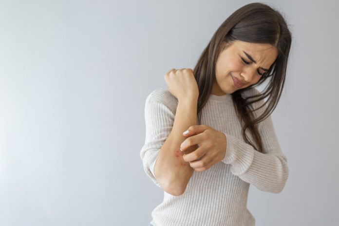 Women scratch the itch with hand